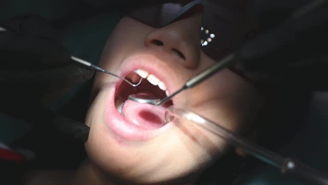 中国少女张口口腔检查视频下载