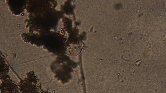 水(池)样本中原生虫涡菌的显微镜观察。滴虫附着在底物上，用细菌吸水。体前纤毛运动放大300倍。视频下载