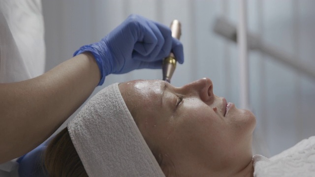 美容师在一个女人的脸上做针刺治疗，特写视频下载