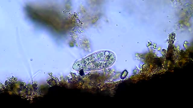Сiliates微生物，显微镜放大40倍视频下载