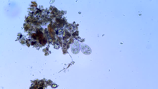 Сiliates微生物，显微镜放大20倍视频素材