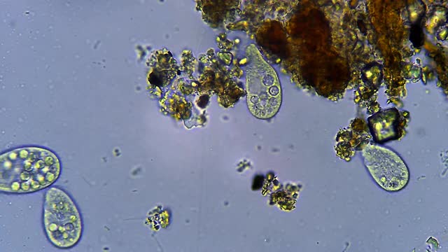 Сiliates微生物，显微镜放大40倍视频素材