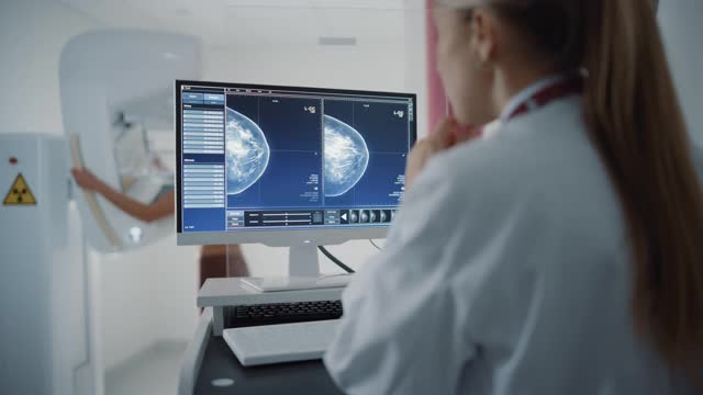 医院放射科病房的电脑屏幕:美丽的多民族成年妇女站在半裸乳房接受乳房x光检查程序。屏幕显示乳腺致密组织的乳房x光扫描。视频下载