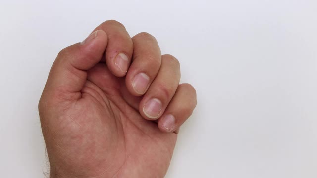 男人的手剪掉了无名指上的钉子。视频素材