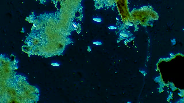 漂浮在水中的纤毛虫微生物群落视频素材