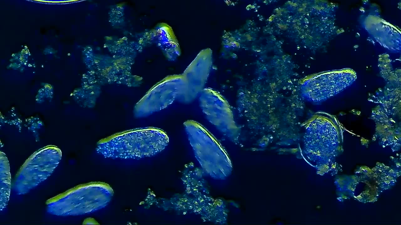 浮水纤毛虫微生物菌落视频下载