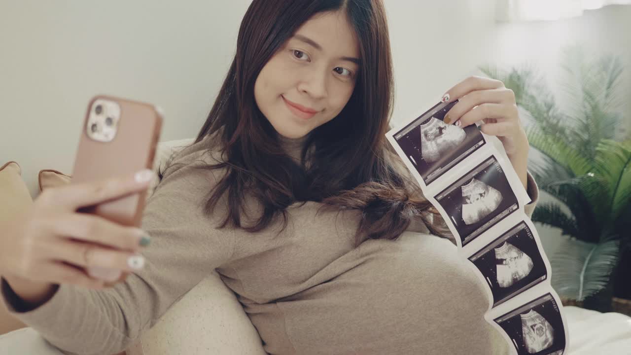 孕妇的超声波图像视频素材