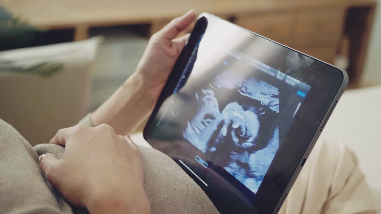 年轻孕妇在数字平板电脑上看超声波图像。视频素材