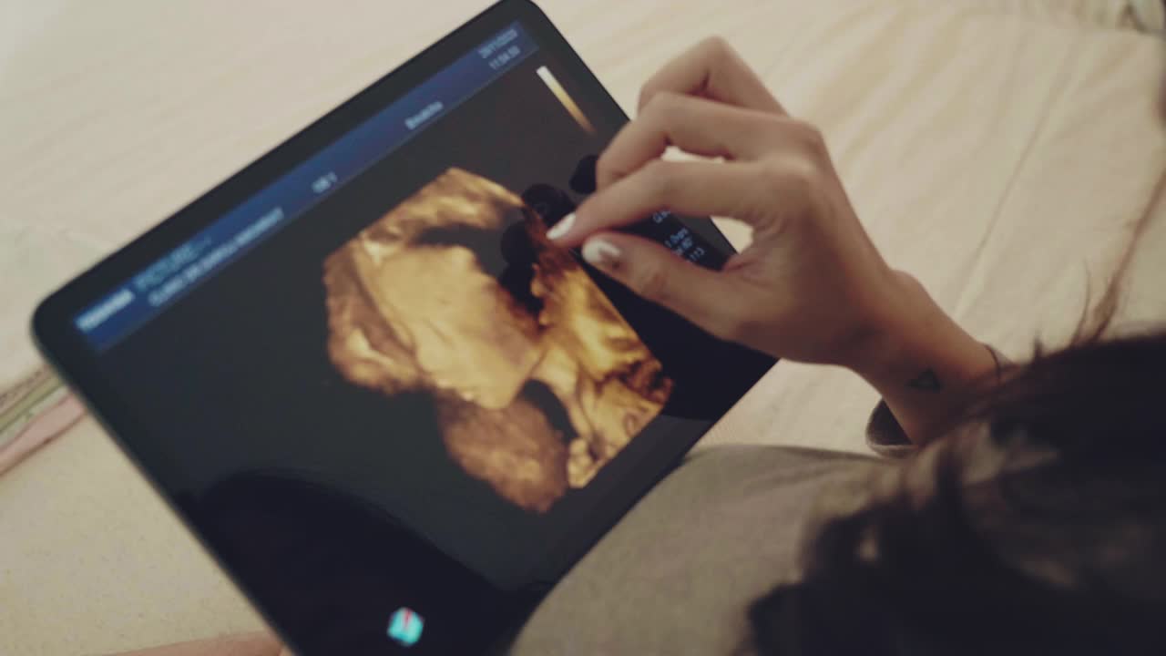 年轻孕妇在数字平板电脑上看超声波图像。视频下载