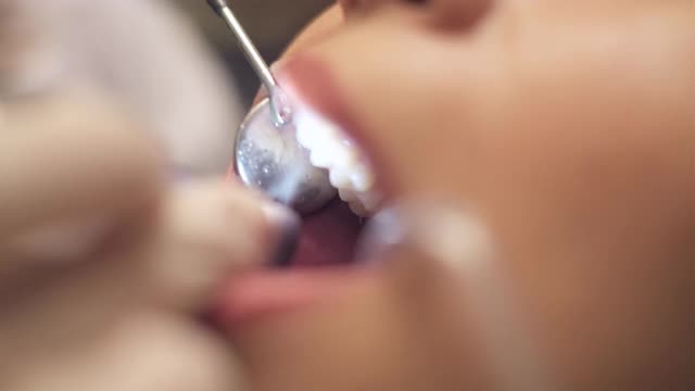年轻女子在看牙医。视频素材