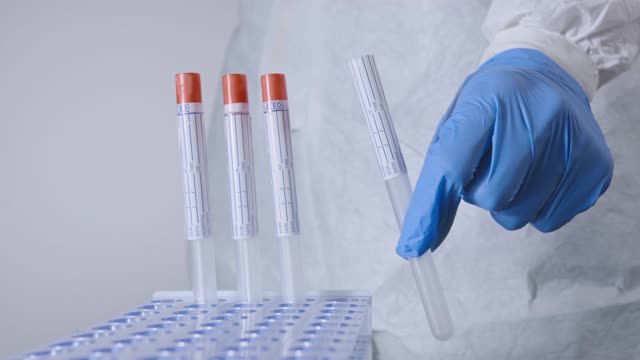 冠状病毒PCR拭子检测视频素材