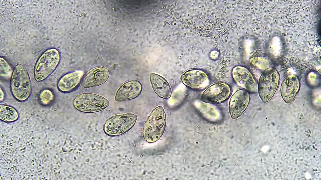 微生物-纤毛虫和细菌视频下载