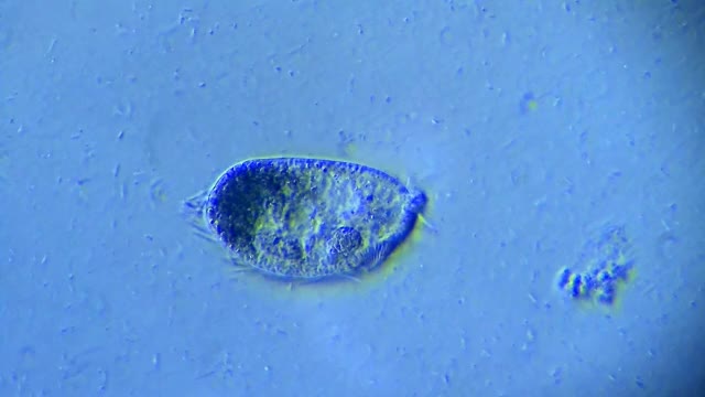 微型生物纤毛虫视频素材