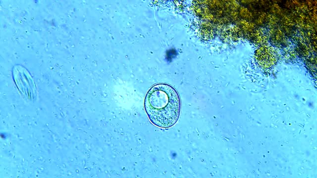 微型生物纤毛虫视频素材
