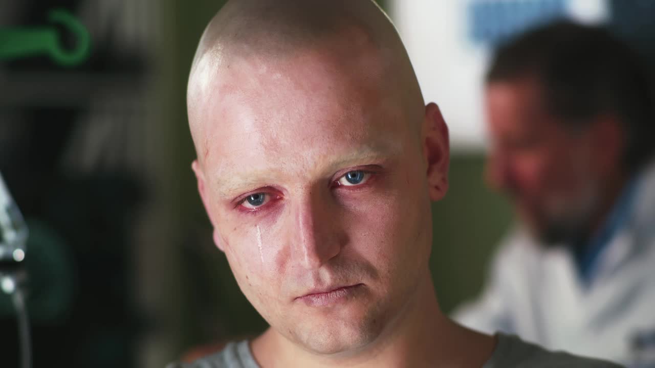 一个患癌症的秃头在医院里哭视频下载