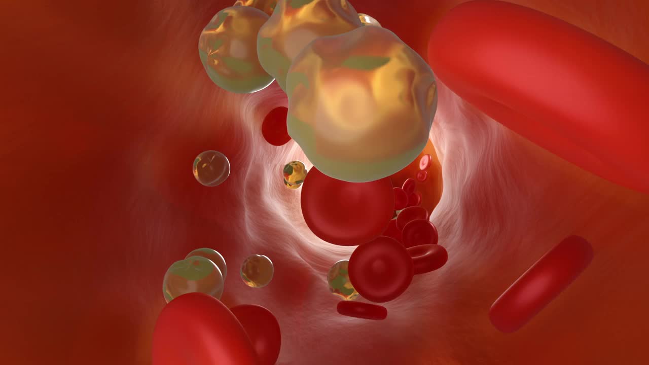 胆固醇细胞阻塞和收紧动脉的三维动画视频下载