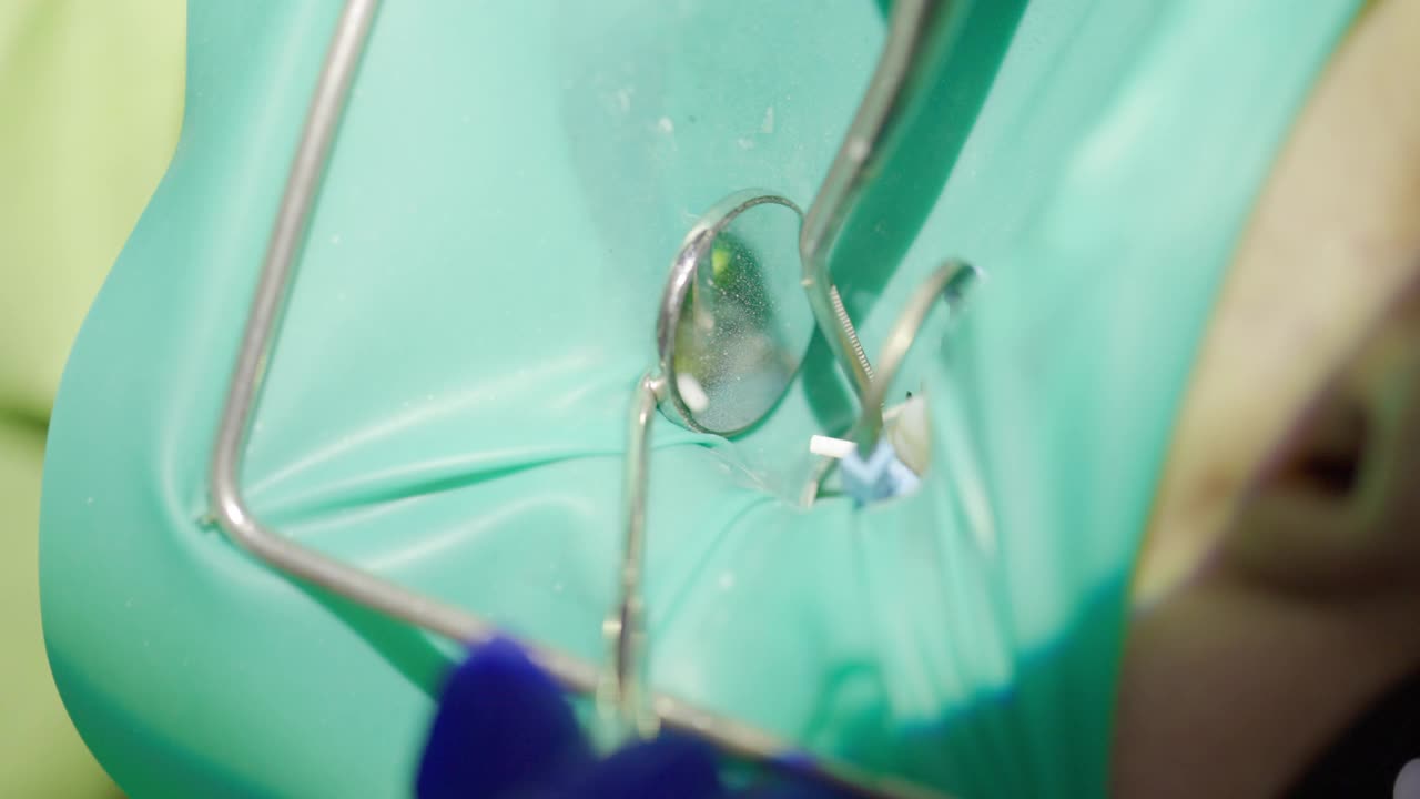 牙科医生在牙科诊所通过显微镜观察病人的牙齿视频素材
