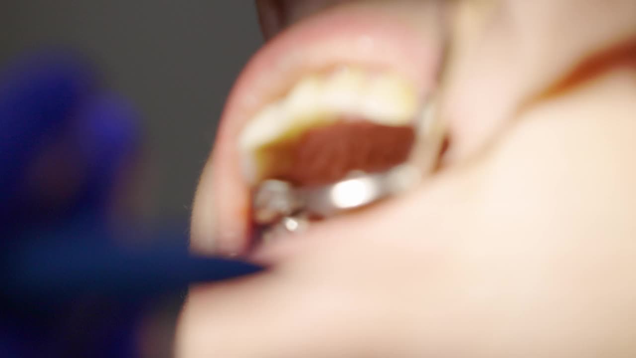 牙科医生在牙科诊所通过显微镜观察病人的牙齿视频素材