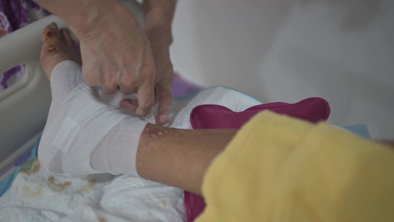 亚洲资深妇女包裹她因糖尿病和压疮伤卧床的丈夫的腿视频下载