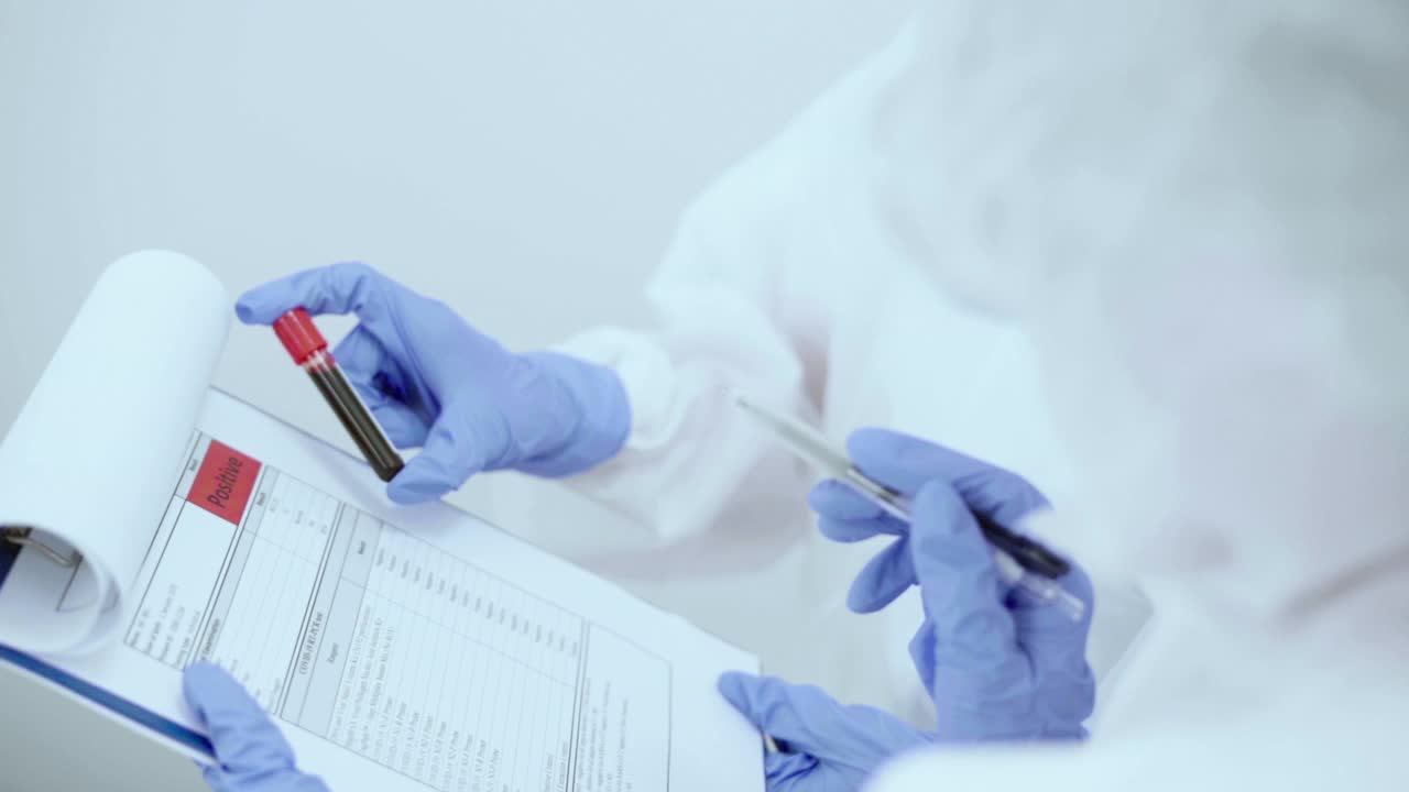 科学家在实验室检测血液和病毒，生产治疗covid-19的疫苗视频素材