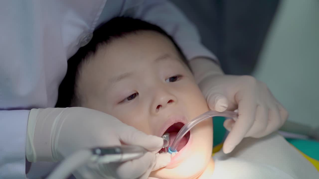 牙科检查的小孩视频下载