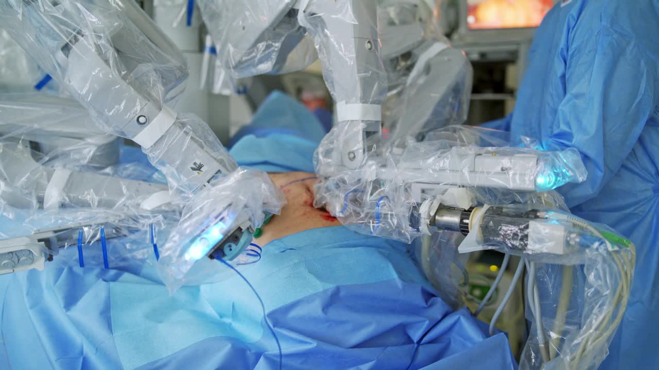 手术过程与机器人设备。未来的机器执行复杂的手术。微创手术创新。医院里的现代科技。视频素材