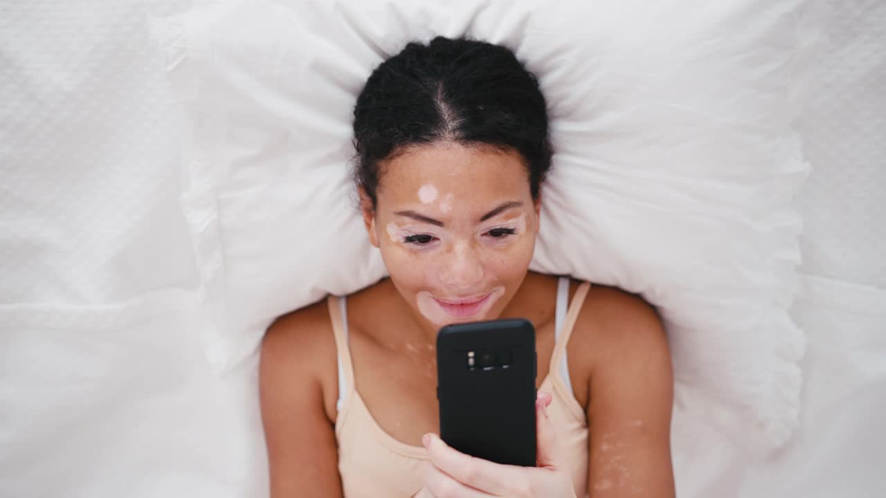一个患白癜风的拉丁女人在床上玩手机视频下载
