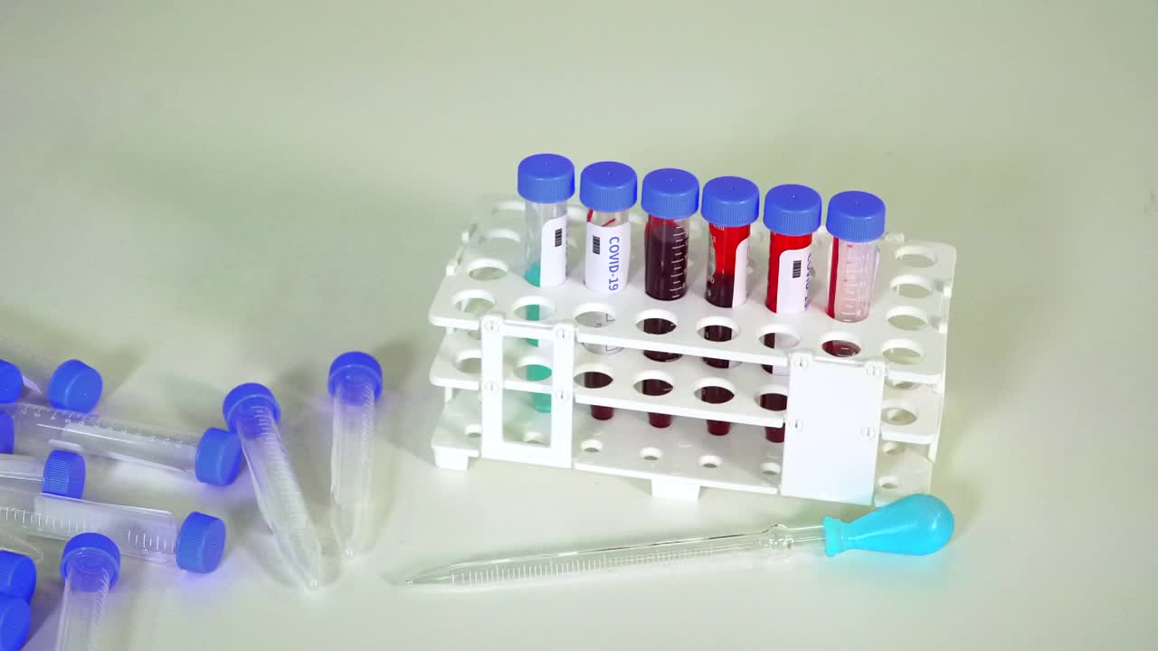 科学实验设备- COVID-19疫苗血液样本视频下载