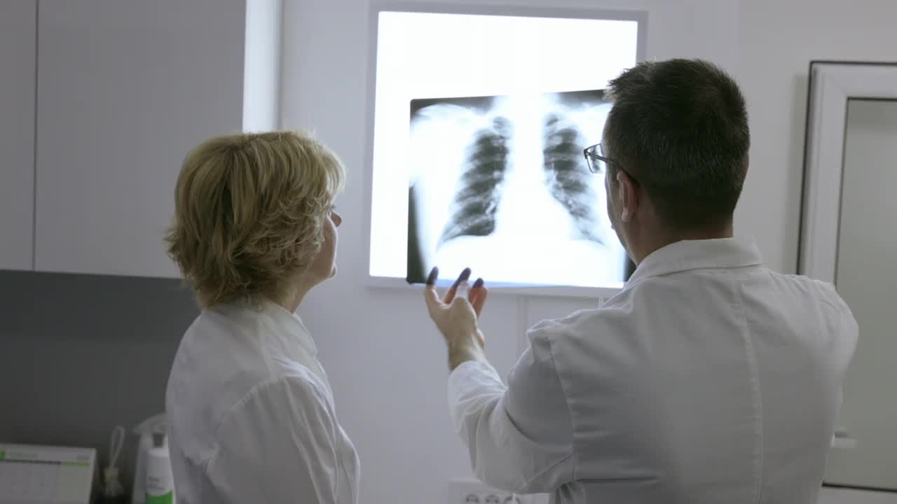 医生和女同事在阴性镜上检查x射线的后视图视频下载