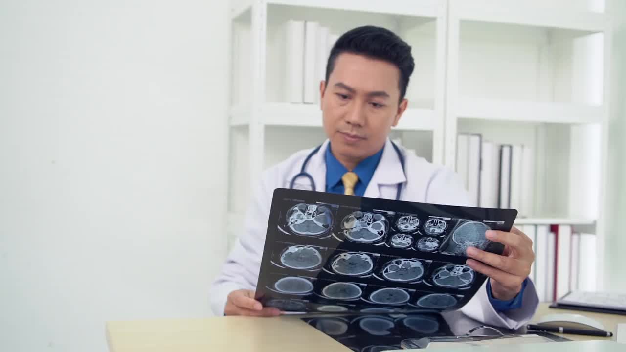 医生对脑部进行了电脑断层扫描并进行了x光检查视频下载