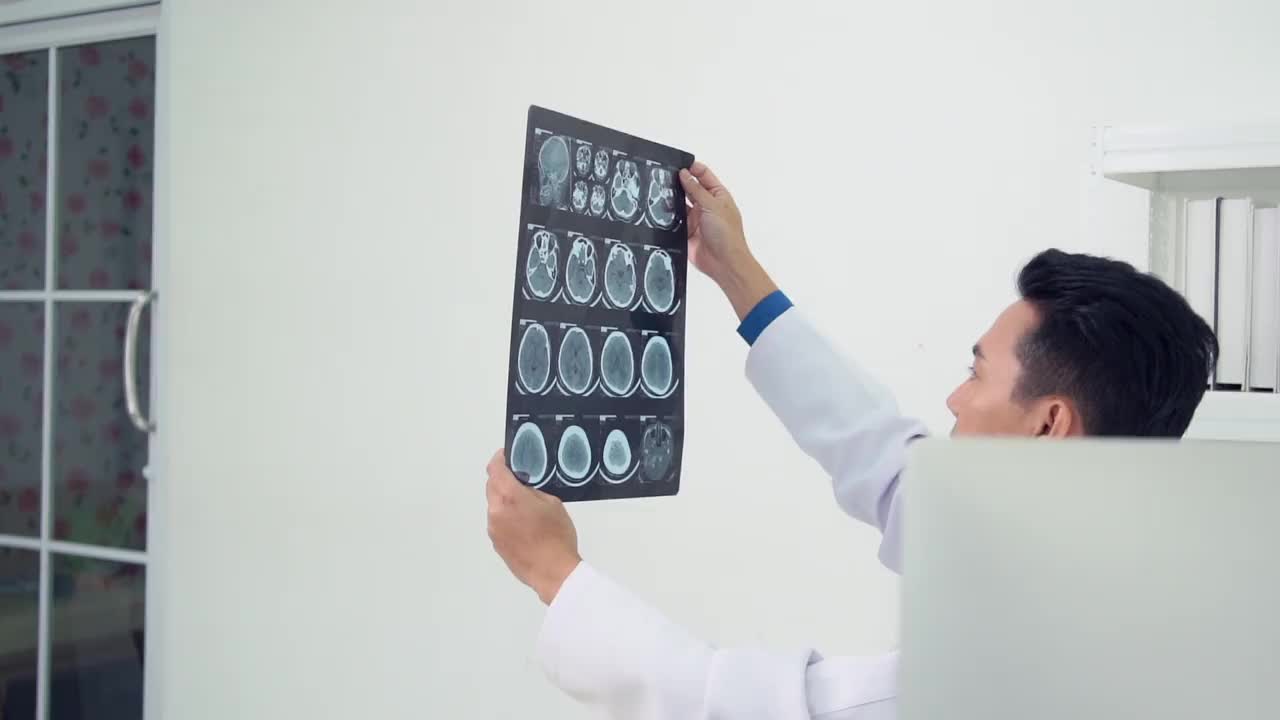 医生对脑部进行了电脑断层扫描并进行了x光检查视频素材