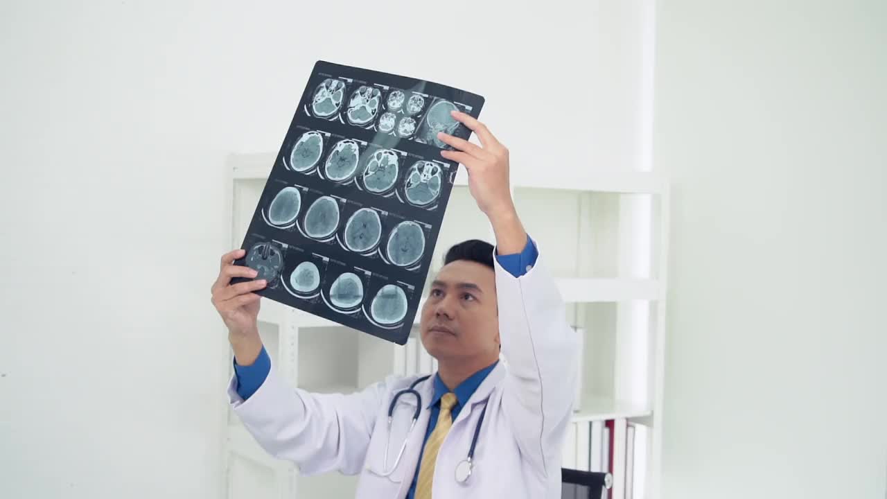 医生对脑部进行了电脑断层扫描并进行了x光检查。视频素材