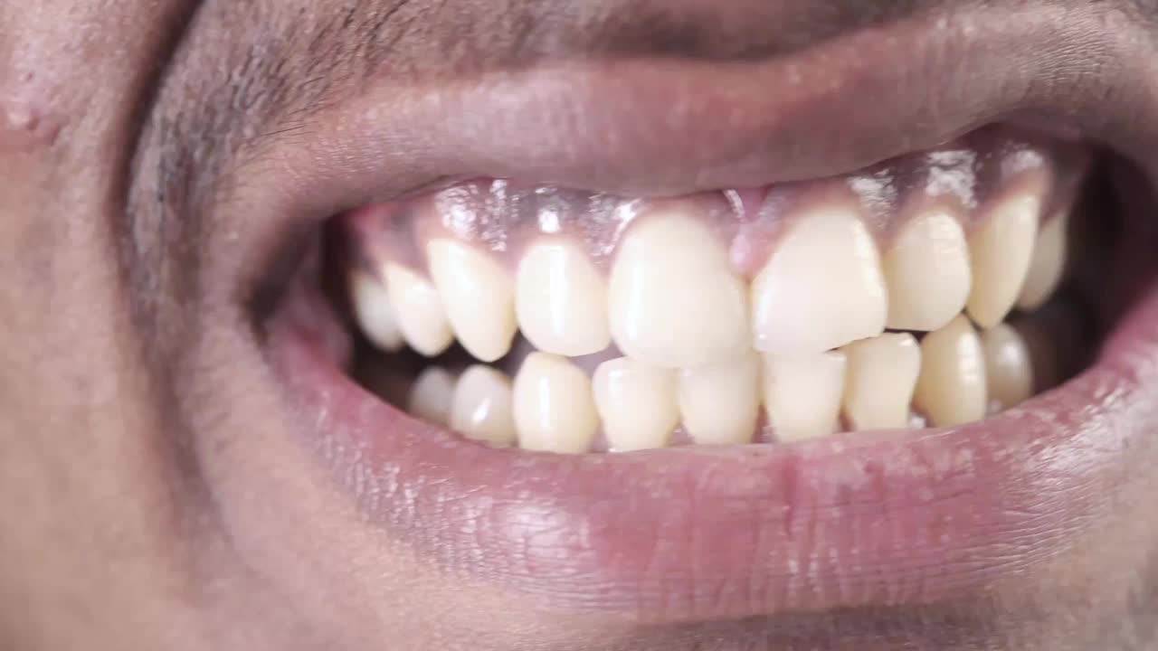 一个男人微笑的牙齿的特写视频素材