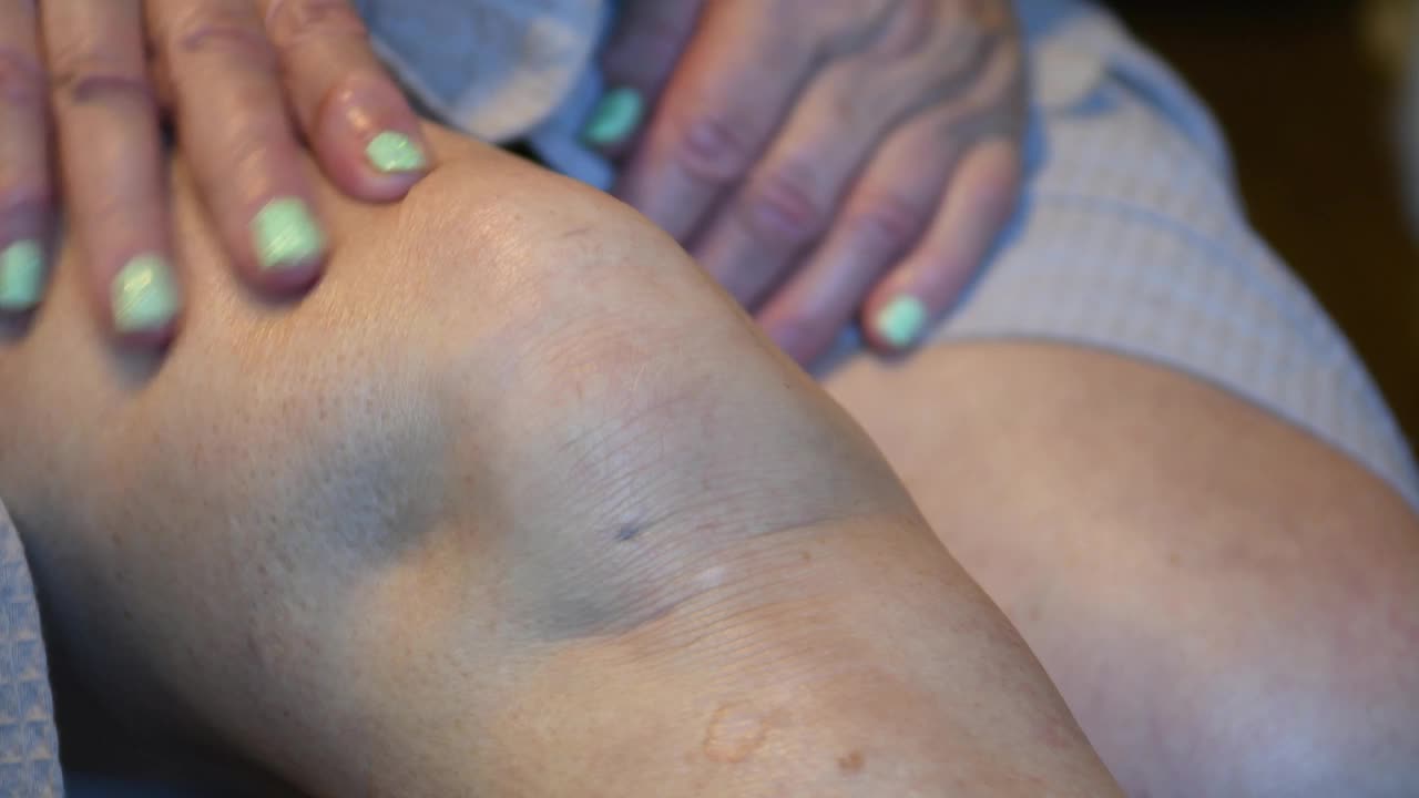 一位上了年纪的妇女在按摩她的膝盖。视频下载