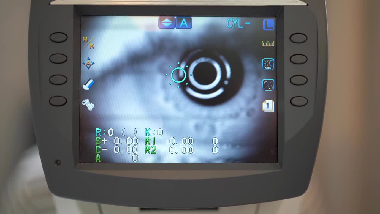 折射仪机器的工作。病人在门诊检查眼睛。显示眼睛检查进展的屏幕。特写镜头。视频下载