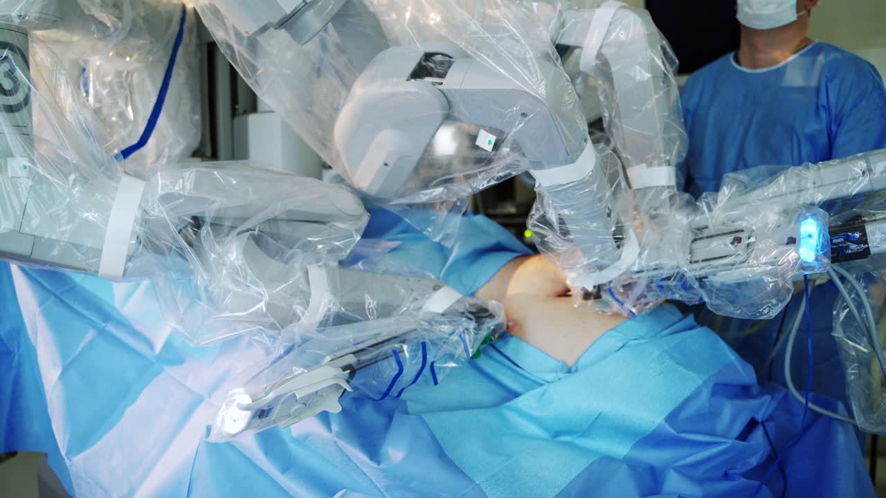 达芬奇系统的手术。医院里的先进机器人手术机器视频下载