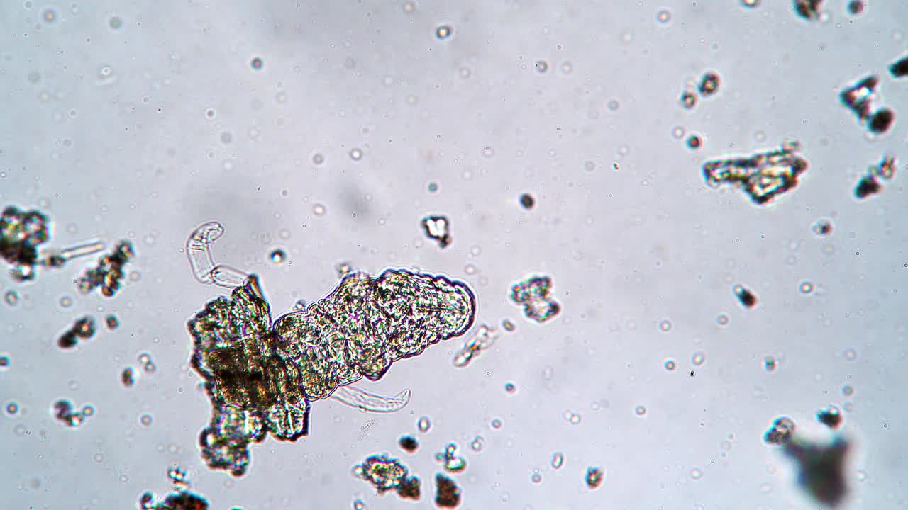 在显微镜下浸泡在水里的苔藓视频下载