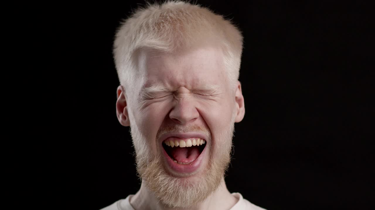 白化病人眨眼睛和张开的嘴在黑色的背景视频下载