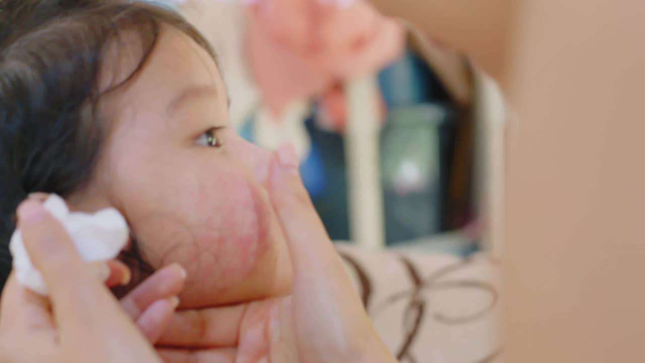 婴儿脸有皮疹通常出现在蹒跚学步的女孩。过敏，孩子脸颊红肿视频下载