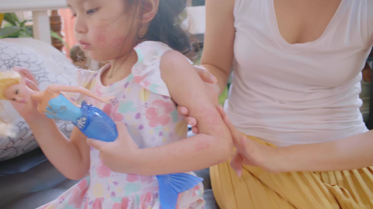 母亲在给蹒跚学步的女儿涂乳液。过敏，孩子脸颊红肿视频下载