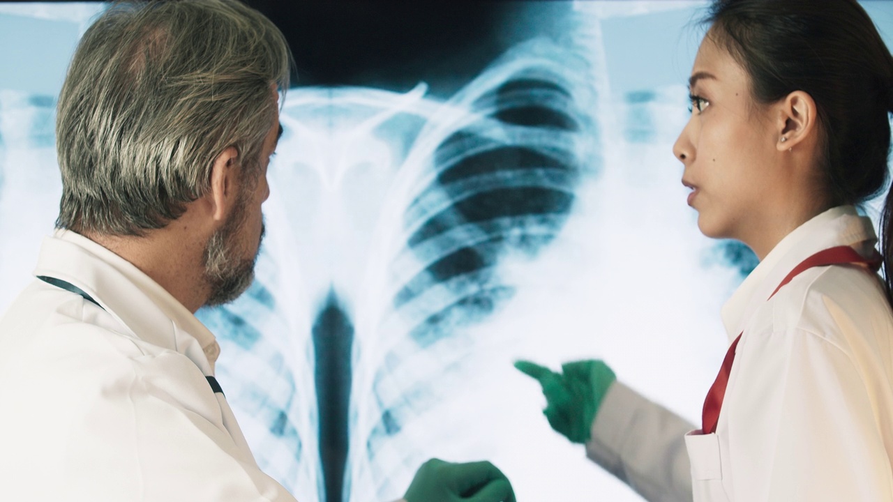 科学家正在观察感染冠状病毒的人类肺部的x光片。谈论covid-19药物。视频下载