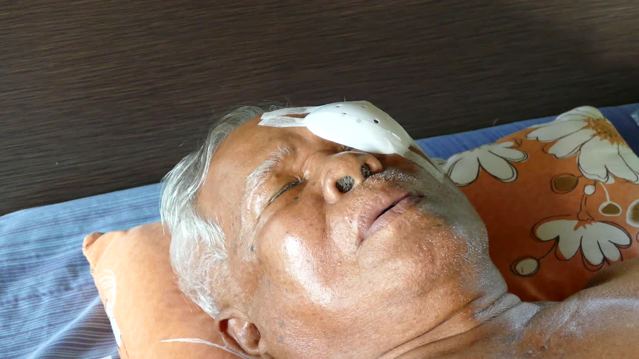 清洁患者老年男性角膜移植术后的眼睛视频素材
