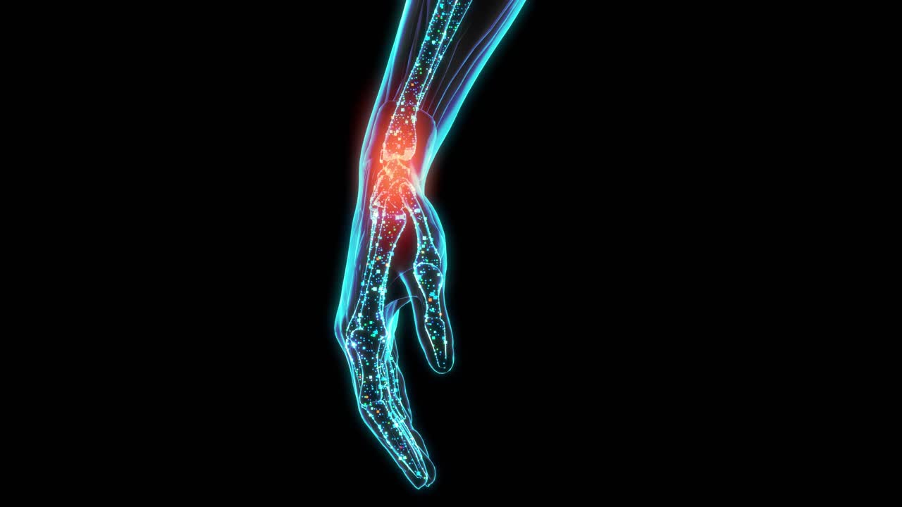 3D可视化数字x射线的人的手与疼痛脉冲，在形式的红色。未来的现代医学，发现健康问题的现代技术。手腕部疼痛感觉的可视化。视频下载