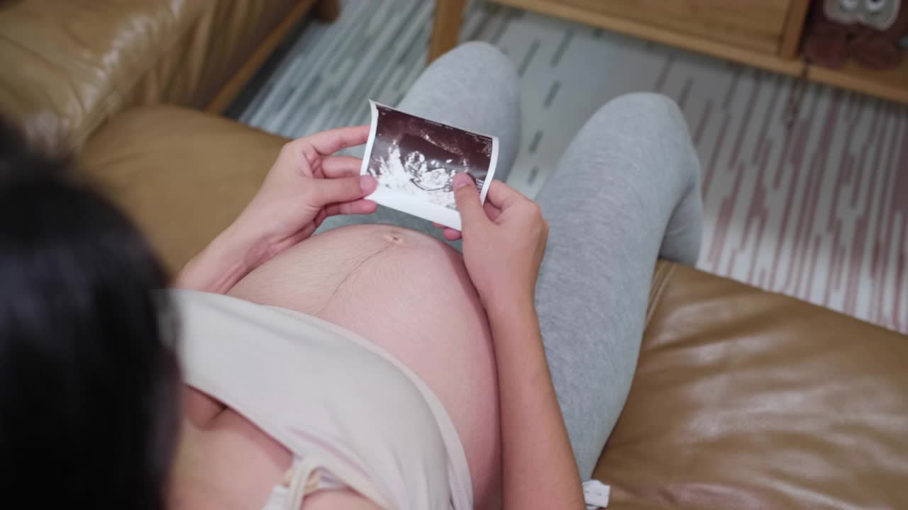快乐孕妇三维超声扫描照片视频下载
