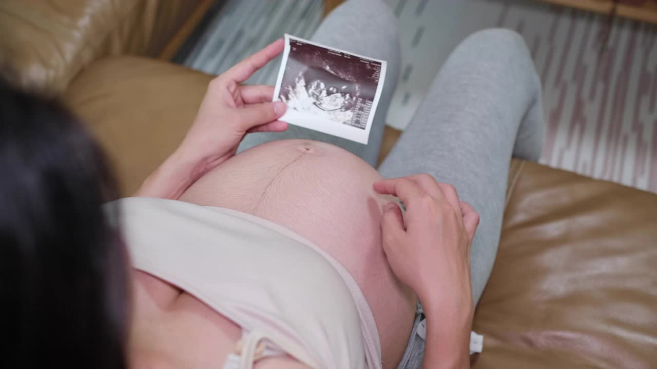 快乐孕妇三维超声扫描照片视频下载