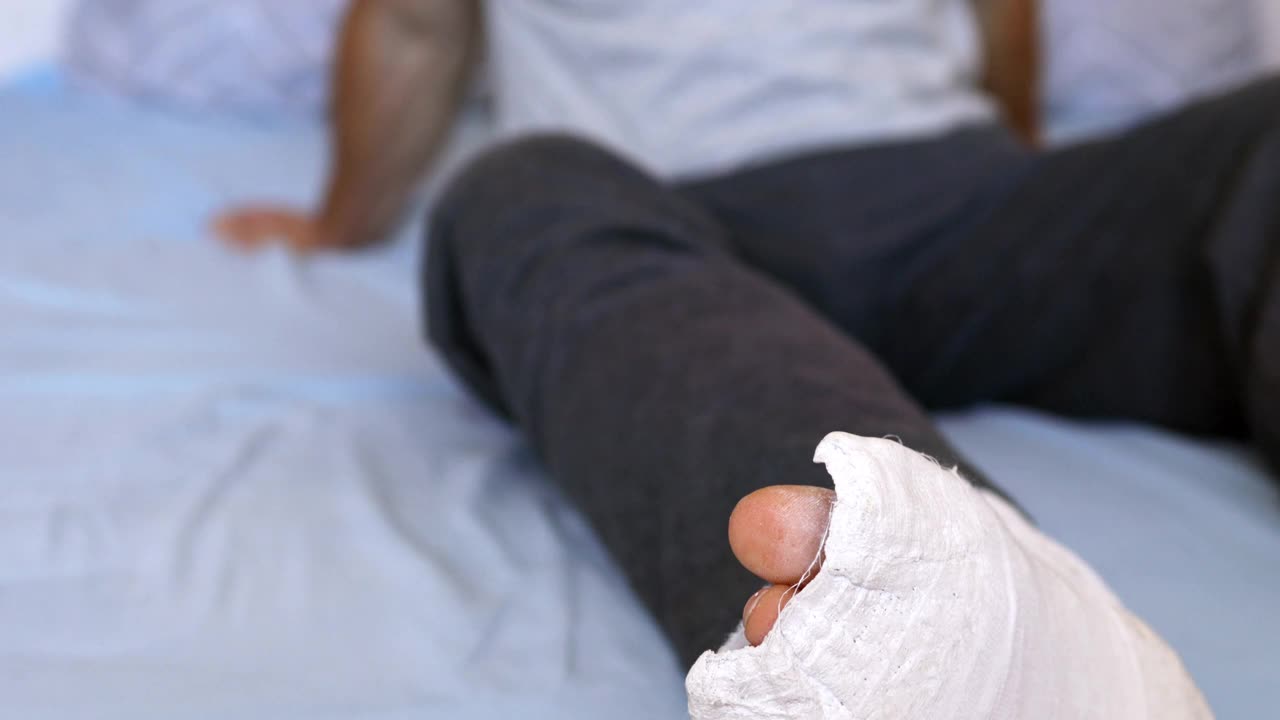 一个打了石膏的人坐在床上试图抓伤一条腿。视频素材