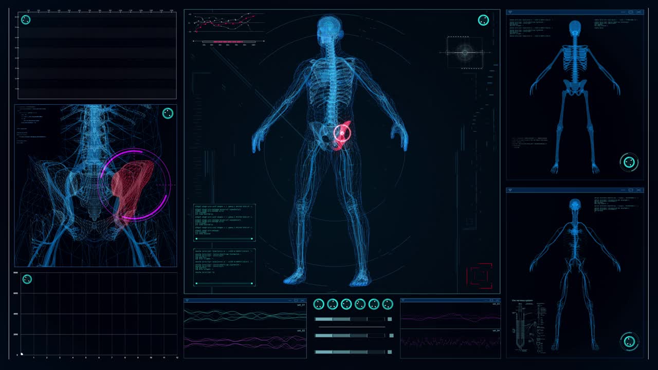 未来实验室。屏幕与动画人体模型。扫描虚拟病人的损伤。臀部有红色斑纹视频素材