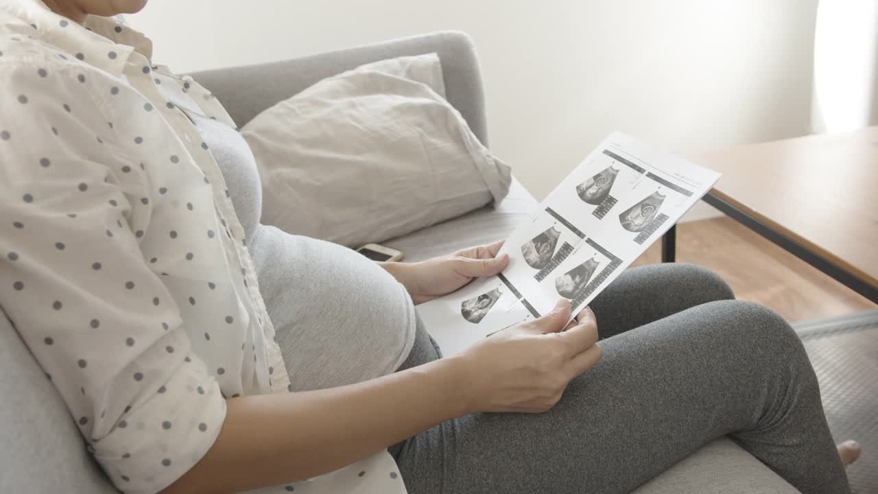 亚洲孕妇坐在沙发上看超声波图像。视频下载