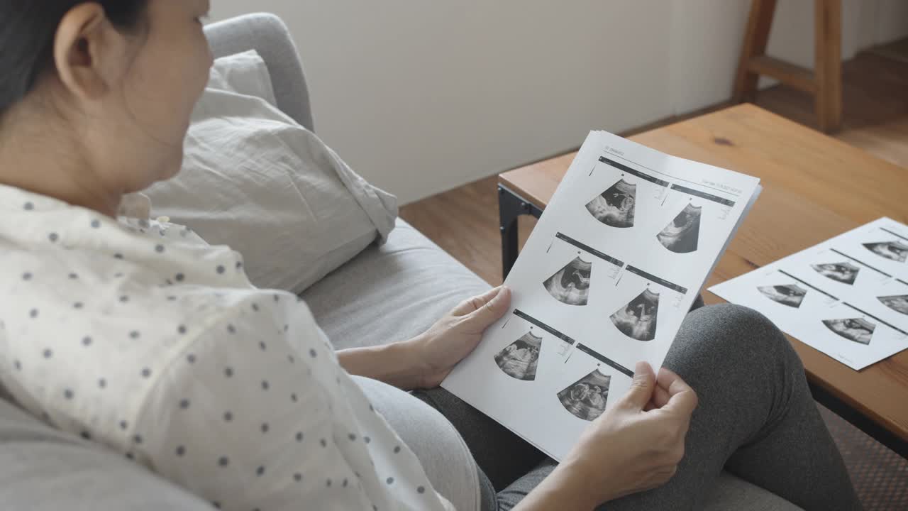 亚洲孕妇坐在沙发上看超声波图像。视频下载