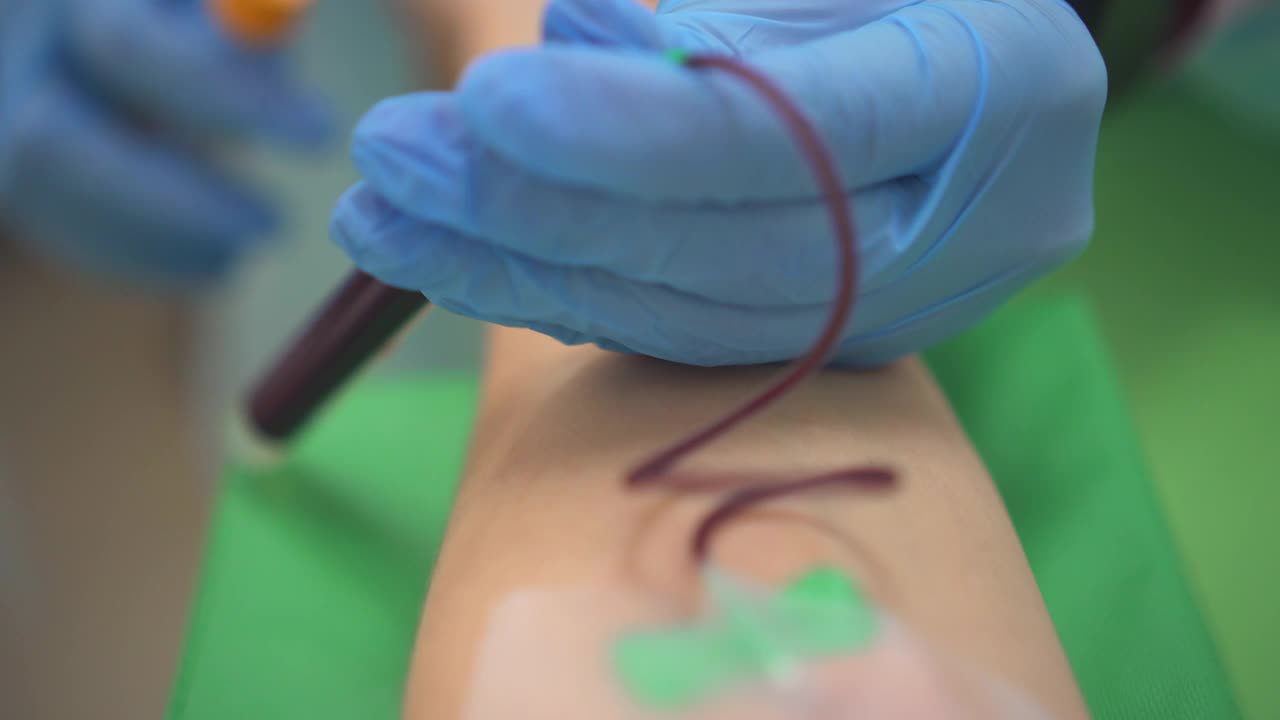 现代临床中，护士从病人手中抽取静脉血视频下载